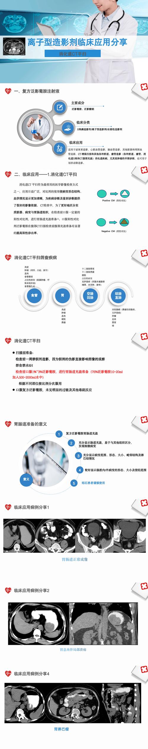 津影通 T 类是什么?它有哪些独特之处和重要作用?快来一探究竟